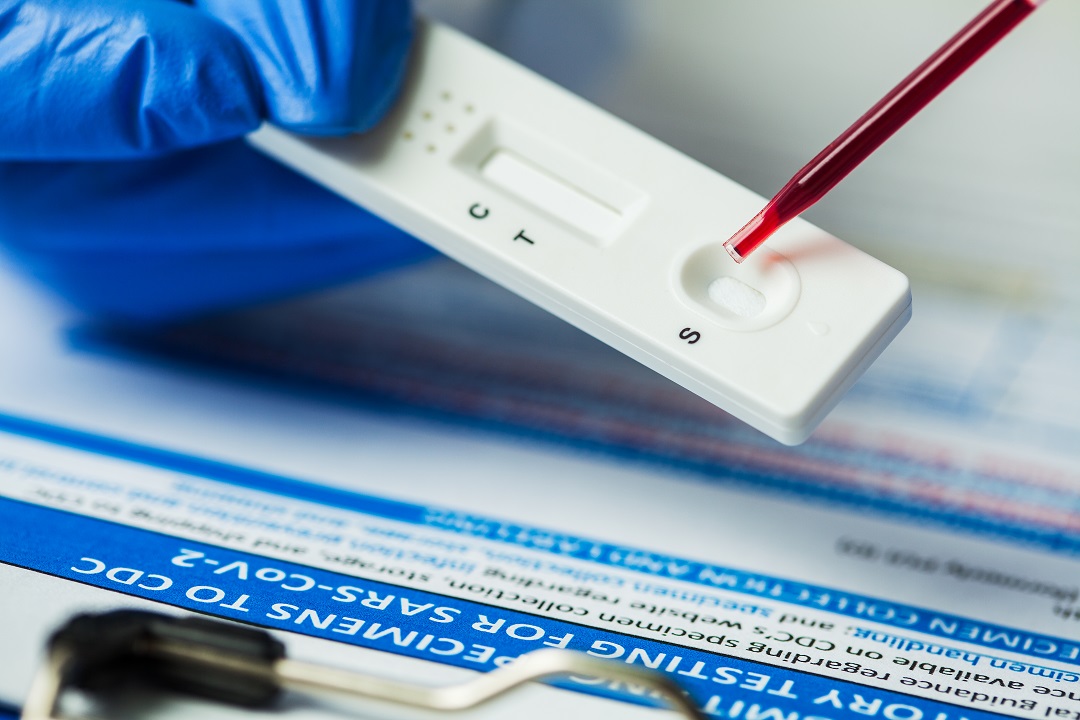 coronavirus test sierologici