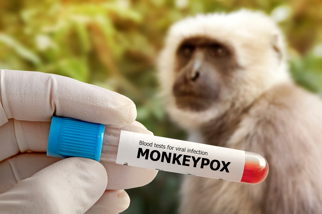 Vaiolo scimmie, dal primo settembre riprendono prenotazioni vaccini