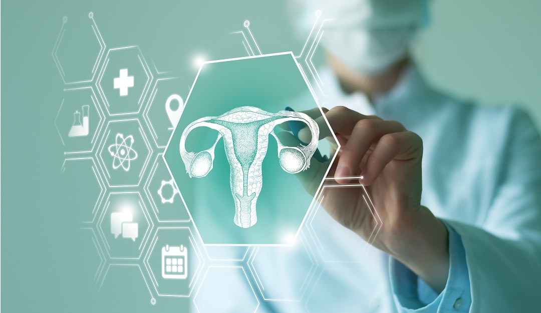 tumore cervice uterina