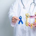 Screening colon retto