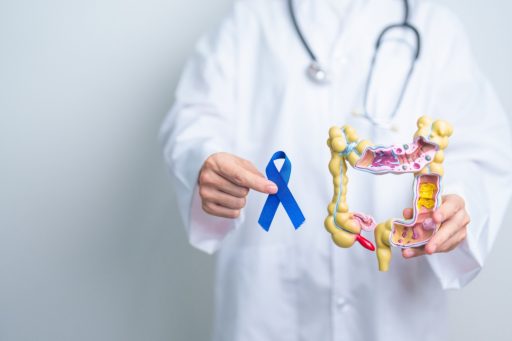 Screening colon retto