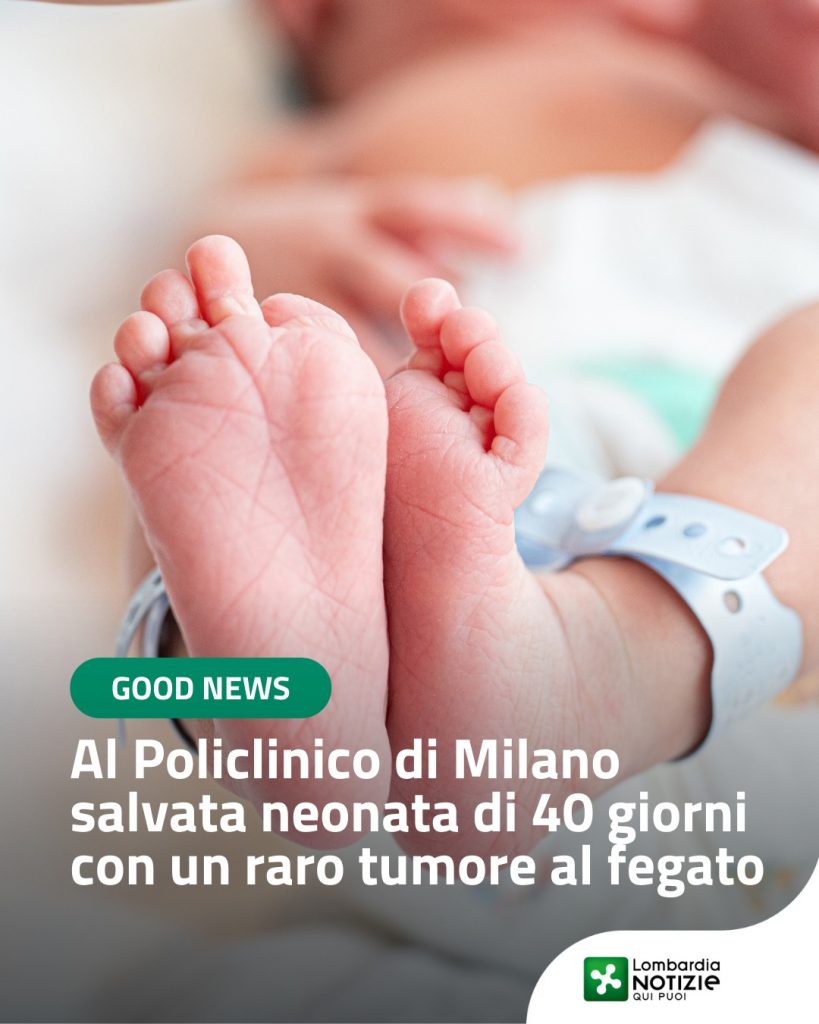 #GoddNews 
Un intervento straordinario al Policlinico di Milano dove una bambina di soli 40 giorni è stata salvata da una rara e voluminosa massa al fegato. L’equipe ha rimosso il tumore con un delicato intervento durato 4 ore, preservando la vita della piccola nonostante l’alto rischio. Un risultato reso possibile grazie alla collaborazione tra la Chirurgia Generale e dei Trapianti di Fegato, la Chirurgia Pediatrica e l’Anestesia Pediatrica. Oggi la piccola sta bene e potrà crescere senza limitazioni. 
Questo traguardo conferma l’eccellenza della sanità lombarda e la forza della collaborazione medica nel proteggere i pazienti più fragili.

#lnews #lombardianotizie @policlinicomilano