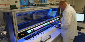 LNews-Foto.SANITÀ. BERGAMO, AL ‘PAPA GIOVANNI XXIII’ LA NUOVA FRONTIERA DELLA DIAGNOSTICA: ARRIVANO INTELLIGENZA ARTIFICIALE E AUTOMAZIONE TOTALE