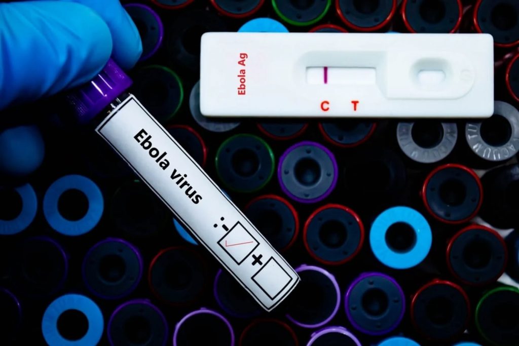 Aggiornamento sanitario dalla Lombardia, assessore @guidobertolaso: esito negativo ai test per Ebola per i due pazienti ricoverati al Sacco di Milano.

Gli accertamenti hanno evidenziato un’infezione batterica a carico dell’apparato gastroenterico. I pazienti sono risultati negativi anche ai test per malaria e principali virus respiratori monitorati.

Al momento non sussistono elementi di allarme per la salute pubblica. #Lombardia 

#Sanità #Lombardia #ebola