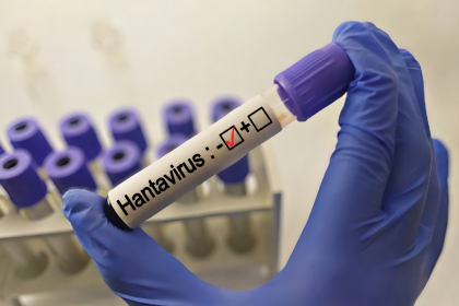 Gli esami sul paziente inglese contatto di Hantavirus hanno dato esito negativo, è in quarantena al Sacco a Milano