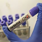 Gli esami sul paziente inglese contatto di Hantavirus hanno dato esito negativo, è in quarantena al Sacco a Milano