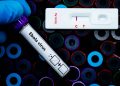 Negativi ai test virologici sull'Ebola i pazienti al 'Sacco' di Milano