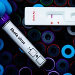 Negativi ai test virologici sull'Ebola i pazienti al 'Sacco' di Milano