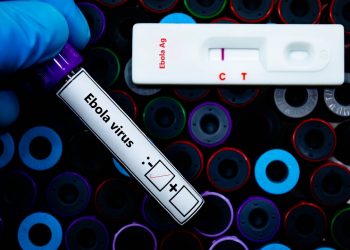 Negativi ai test virologici sull'Ebola i pazienti al 'Sacco' di Milano