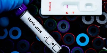 Negativi ai test virologici sull'Ebola i pazienti al 'Sacco' di Milano