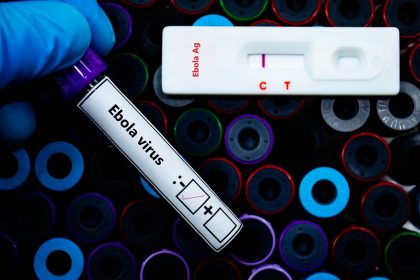 Negativi ai test virologici sull'Ebola i pazienti al 'Sacco' di Milano