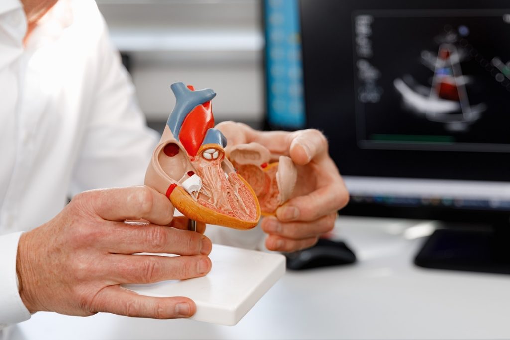 La foto mostra un modello anatomico di un cuore tenuto in mano da un medico. Foto utilizzata per articolo Policlinico di Milano tecniche mininvasive