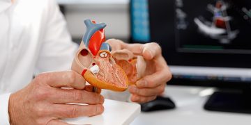 La foto mostra un modello anatomico di un cuore tenuto in mano da un medico. Foto utilizzata per articolo Policlinico di Milano tecniche mininvasive