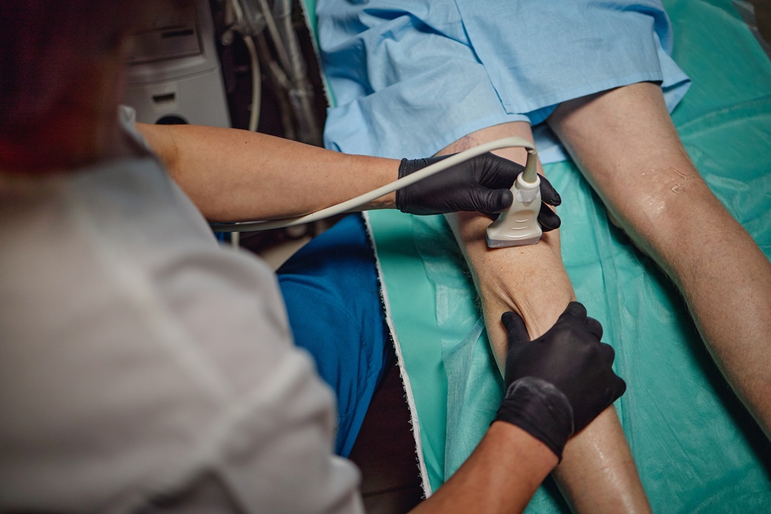 Uomo riceve esame ecografico vascolare sulla parte inferiore della gamba da un medico che indossa guanti in ambiente clinico. Immagine utilizzata per Rete regionale della Chirurgia Vascolare di Regione Lombardia. _Shutterstock 270826