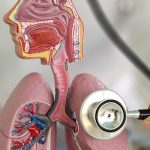 Al policlinico di Milano eseguito un doppio trapianto di polmoni e sostituita la valvola mitralica